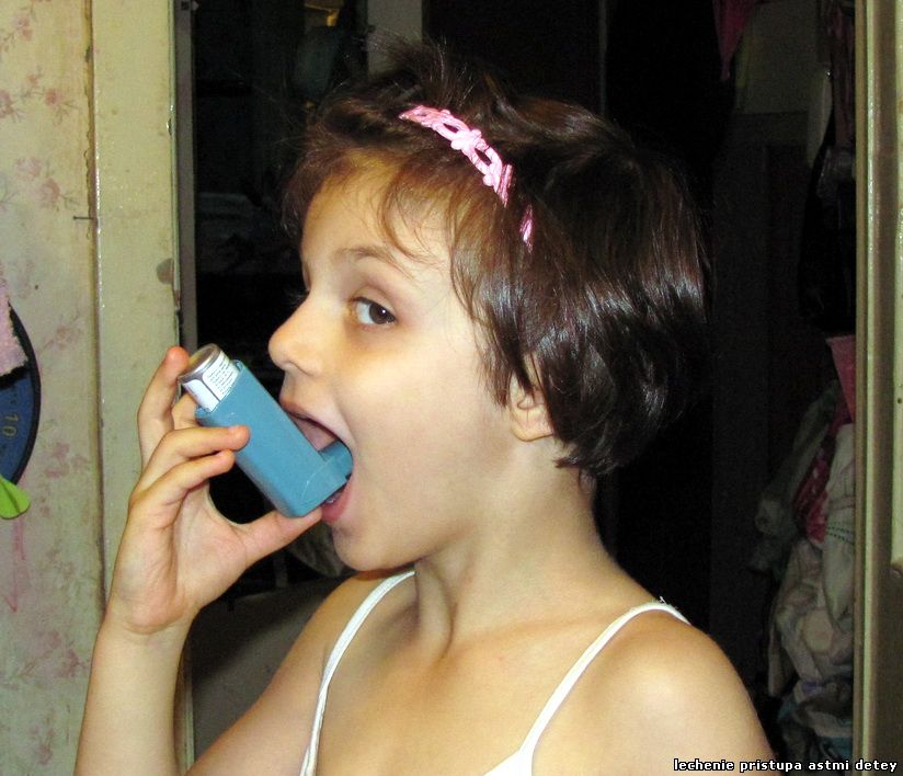 Лечение приступа бронхиальной астмы.